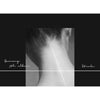 Gummy - [Stroke] (5th Album)